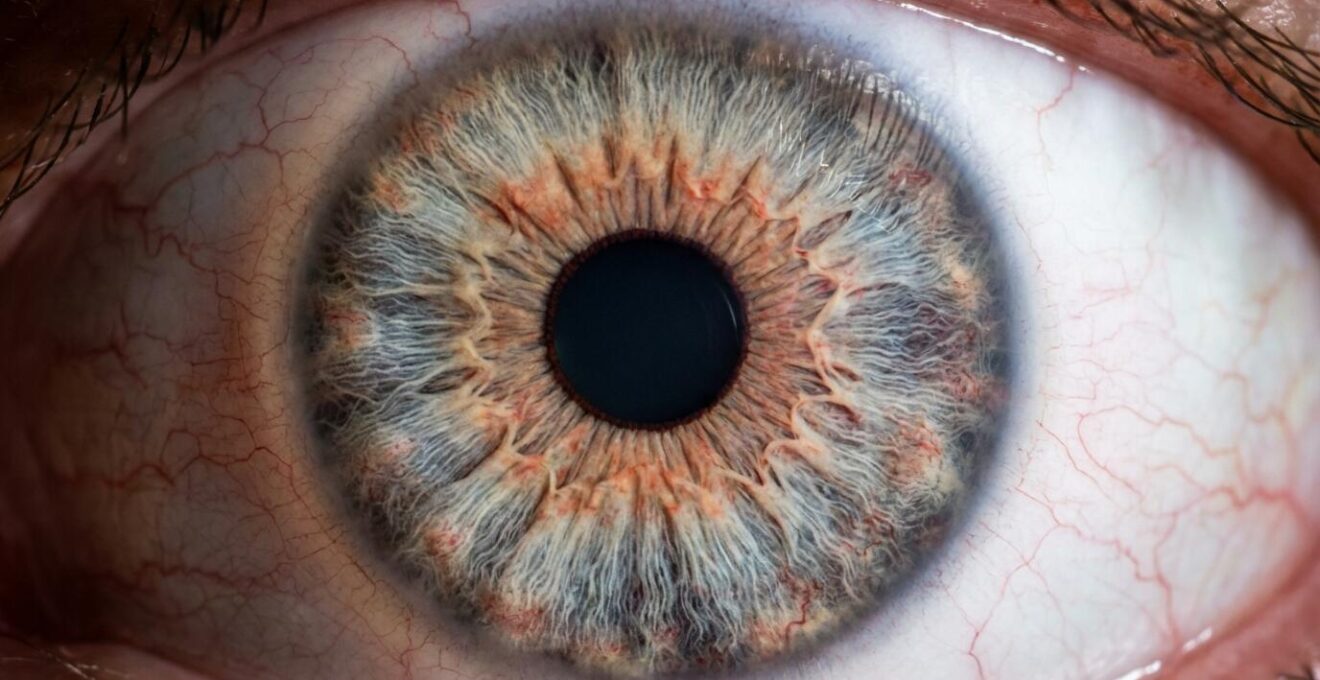 Extreme close-up of an eye during an examination, showing the detailed texture of the iris.