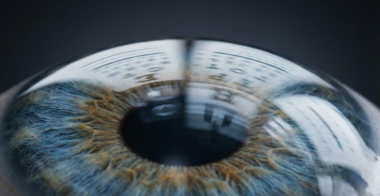Close-up view of eye examination showing optical refraction measurement process