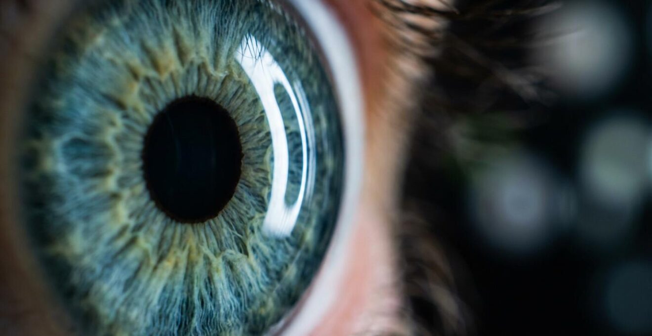 Close-up macro view of eye examination showing retinal detail